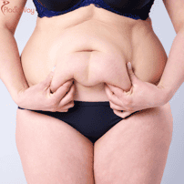 Abdominoplastia y levantamiento de senos: el cambio de imagen perfecto para mamás en Colombia
